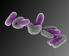 Dette bildet viser flere Bacillus licheniformis-sporer som våkner, eller germinerer. Bakteriene er egentlig ikke lilla, men bildet er fargelagt for å tydeliggjøre prosessen. Foto: NMBU