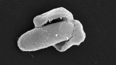 Her ser vi en Bacillus licheniformis-spore som våkner til live. Sporeskallet sprekker og en voksende bakterie kommer ut. Foto: NMBU