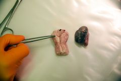 Eksempel på hvordan prøvene fra hjerne (til venstre) og lymfeknuter skal se ut. Foto: Veterinærinstituttet
