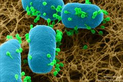 De ulike bakteriofagene har sine favorittbakterier som de jakter på. Her ser du bakteriofager i grønt som går til angrep på bakteriene i blått. Foto: Miika Leppänen/University of  Jyväskylä