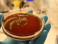 En stor del av Junges' forskning har gått ut på å dyrke bakterier i skåler med næringsgelé. Her en skål med Streptococcus pneumoniae-bakterier. Foto: Roger Junges, Det Odontologiske fakultet/UiO.