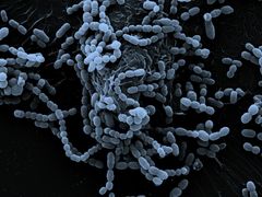 Mikroskopbilde av Streptococcus mitis viser hvordan de vokser i lenker. Foto: Roger Junges, Det Odontologiske fakultet/UiO.