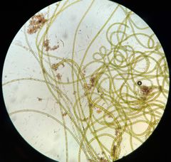 I mikroskopet ser man at algene i all hovedsak består av trådformede grønnalger. På bildet er det mest Microspora, men også Oedogonium og Spirogyra, samt noen andre alger. (Foto: NIVA)