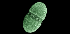 Bakterien E. Faecalis Foto: Wikipedia Commons Public Domain, http://www.genome.gov