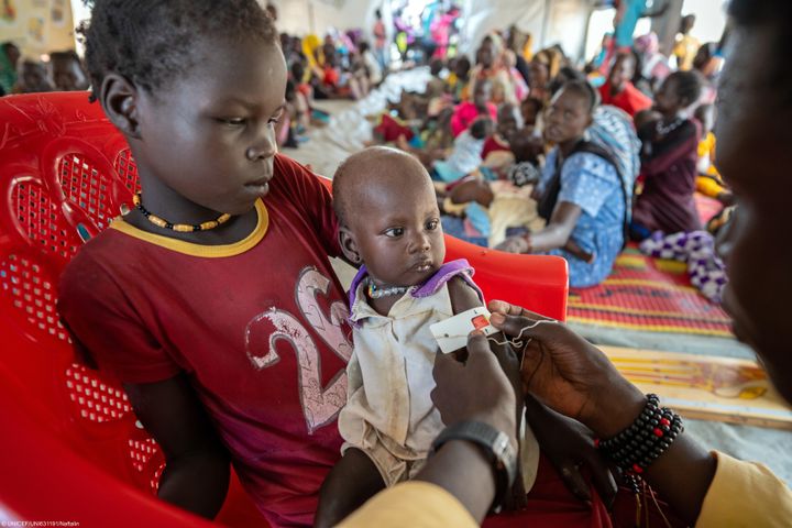 Et lite barn undersøkes for underernæring på et UNICEF-støttet senter i Sudan. Foto: UNICEF/UNI631191