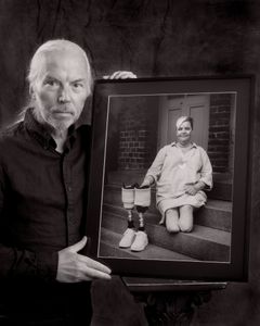 Fotograf Roy W Gabrielsen med et portrett av Kristin Hansen som måtte amputere begge ben etter å ha fått et gnagsår. (Foto: Roy W Gabrielsen)