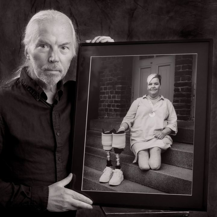 Fotograf Roy W Gabrielsen med et portrett av Kristin Hansen som måtte amputere begge ben etter å ha fått et gnagsår. (Foto: Roy W Gabrielsen)