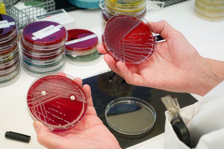 Laboratorieskåler med bakterier i.