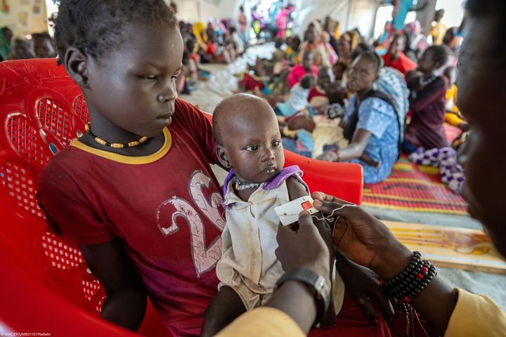 Et lite barn undersøkes for underernæring på et UNICEF-støttet senter i Sudan.