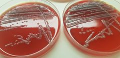 Renkultur E. coli på blodskål eller blodagar. Foto: Inger Helene Kravik, Veterinærinstituttet
