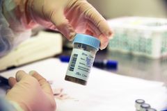 Innsendt rør/prøveglass med prøver fra elg. Foto: Mari M. Press, Veterinærinstituttet