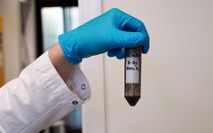 En av jordprøvene under ekstraksjon av rottegiftene. Jordprøvene er fra et forsøk hvor NIBIO i samarbeid med Veterinærinstituttet undersøker hvordan ulike varianter av rottegifter brytes ned over tid i ulike jordtyper. I prosjektet undersøker forskerne forskjell på hvordan de kjemiske stoffene i rottegiftene brytes ned i de forskjellige jordtypene. Foto: Mari M. Press, Veterinærinstituttet