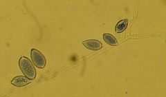 Organismen Phytophthora infestans er i slekt med algar, men liknar på sopp. Sjukdomen spreier seg lett, anten gjennom sporar i luft og vatn, eller via smitta settepoteter.