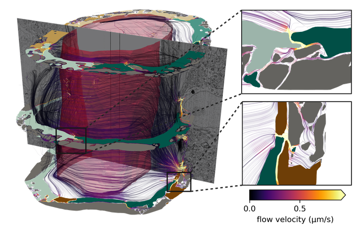 En%20digital%20visualisering%20fra%20datamodellen%20viser%20en%20blod%E5re%2C%20de%20omkringliggende%20hulrommene%20og%20astrocuttendef%F8tter%20i%20hjernen.