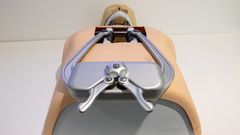 Bryståpneren som skal konkurrere mot det som i dag er standardinstrument på de fleste sykeshus: Finochietto-sternumsprederen.