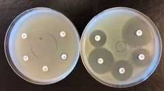 Vekst av resistente bakterier sådd ut en agarskål på mikrobiologisk laboratorium OUS Ullevål. De hvite lappene inneholder ulike antibiotika. På skålen til høyre: Ikke-resistente bakterier blir drept av antibiotikaen, og vi ser det som en oppklaring rundt lappene. På skålen til venstre: Bakteriene som vokser helt inntil lappen er resistente.