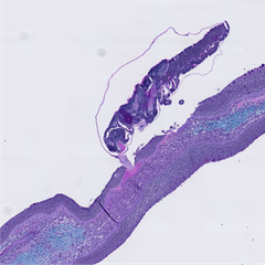 A sea louse (on top) attaches itself to a fish fin